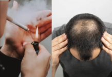 Da li pušenje uzrokuje opadanje kose?