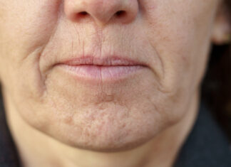 Simptom DEMENCIJE koji se javlja u ustima: Ako ga osjetite, obratite se ljekaru! Simptom DEMENCIJE koji se javlja u ustima: Ako ga osjetite, obratite se ljekaru! - featured image