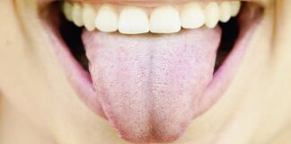 BIJELI PREMAZ NA JEZIKU? Nikada nemojte zanemariti ovaj simptom – 2 važna organa mogu biti oslabljena… BIJELI PREMAZ NA JEZIKU? Nikada nemojte zanemariti ovaj simptom – 2 važna organa mogu biti oslabljena… - featured image