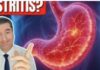Ovaj čaj uklanja gastritis za samo par minuta – ISPROBAJTE GA! Ovaj čaj uklanja gastritis za samo par minuta – ISPROBAJTE GA! - featured image